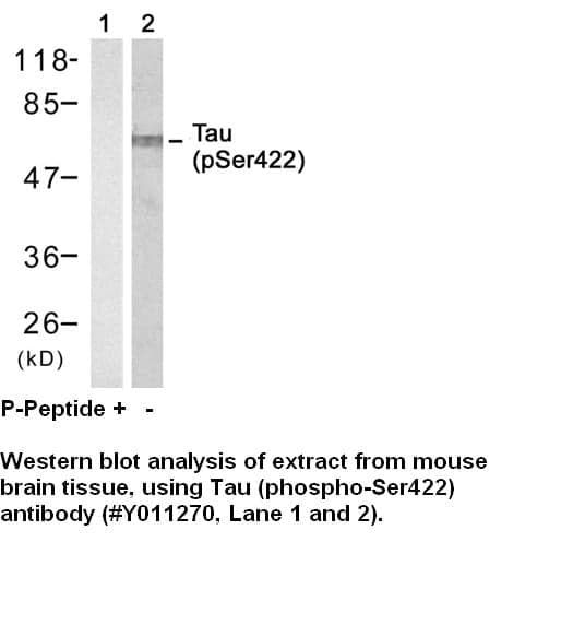 Anti-Tau (Phospho-Ser422)