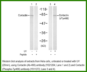 Anti-Cortactin (Phospho-Tyr466)