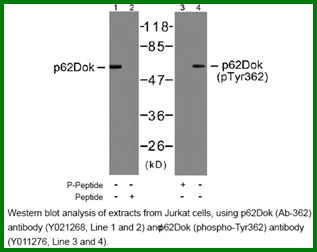 Anti-p62Dok (phospho-Tyr362)