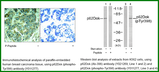 Anti-p62Dok (phospho-Tyr398)