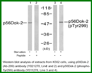 Anti-p56Dok-2 (Phospho-Tyr299)