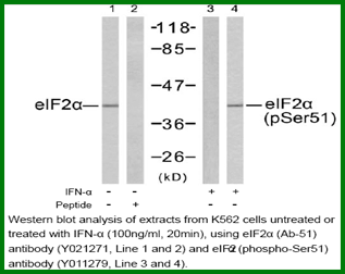 Anti-eIF2&alpha; (Phospho-Ser51)