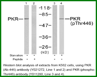Anti-PKR (Phospho-Thr446)