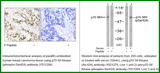 Anti-p70 S6 Kinase (Phospho-Ser424)