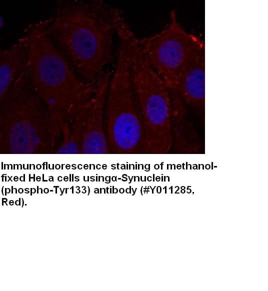 Anti-&beta;-Synuclein (Phospho-Tyr133)