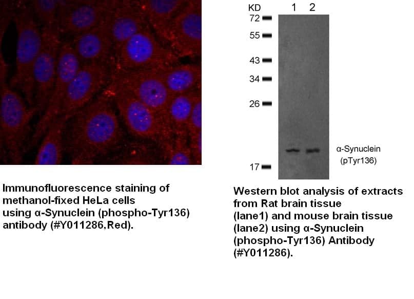 Anti-&beta;-Synuclein (Phospho-Tyr136)
