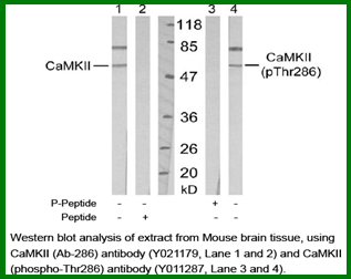 Anti-CaMKII (Phospho-Thr286)