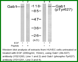 Anti-Gab1 (Phospho-Tyr627)