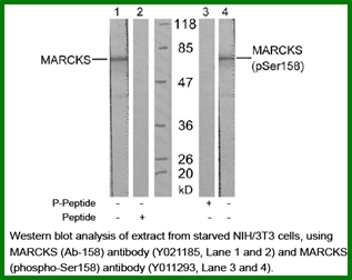 Anti-MARCKS (Phospho-Ser158)