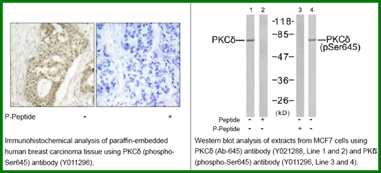 Anti-PKC&delta; (Phospho-Ser645)