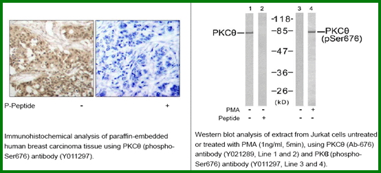 Anti-PKC&theta; (Phospho-Ser676)