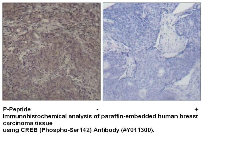 Anti-CREB (Phospho-Ser142)