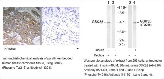 Anti-GSK3&beta; (Phospho-Tyr216)