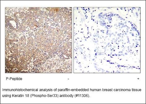 Anti-Keratin 18 (Phospho-Ser33)