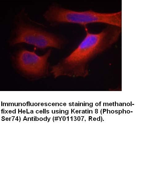 Anti-Keratin 8 (Phospho-Ser74)