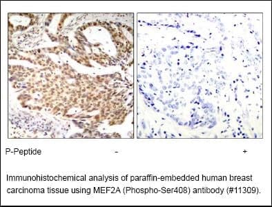 Anti-MEF2A (Phospho-Ser408)