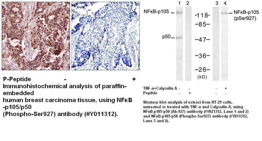 Anti-NFκB-p105/p50 (Phospho-Ser927)
