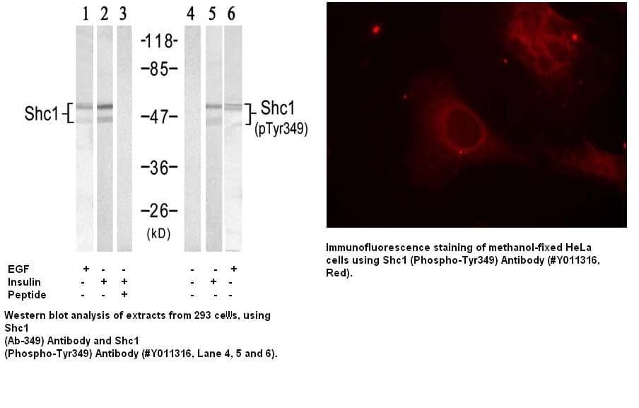 Anti-Shc1 (Phospho-Tyr349)