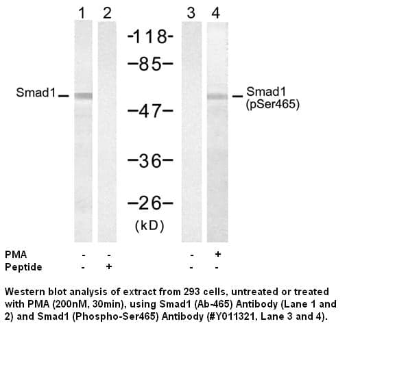 Anti-Smad1 (Phospho-Ser465)