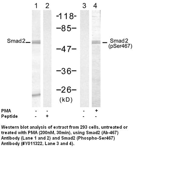 Anti-Smad2 (Phospho-Ser467)