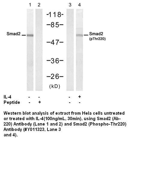 Anti-Smad2 (Phospho-Thr220)