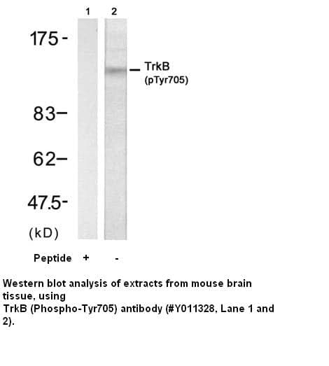 Anti-TrkB (Phospho-Tyr705)