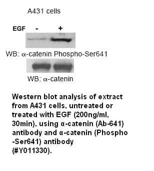 Anti-ß-catenin (Phospho-Ser641)