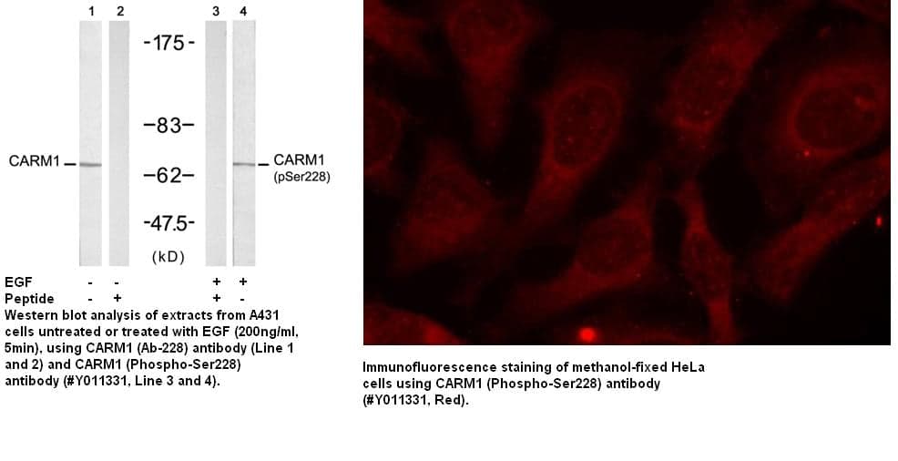 Anti-CARM1 (Phospho-Ser228)
