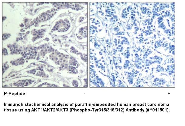 Anti-AKT1/AKT2/AKT3 (phospho-Tyr315/316/312)