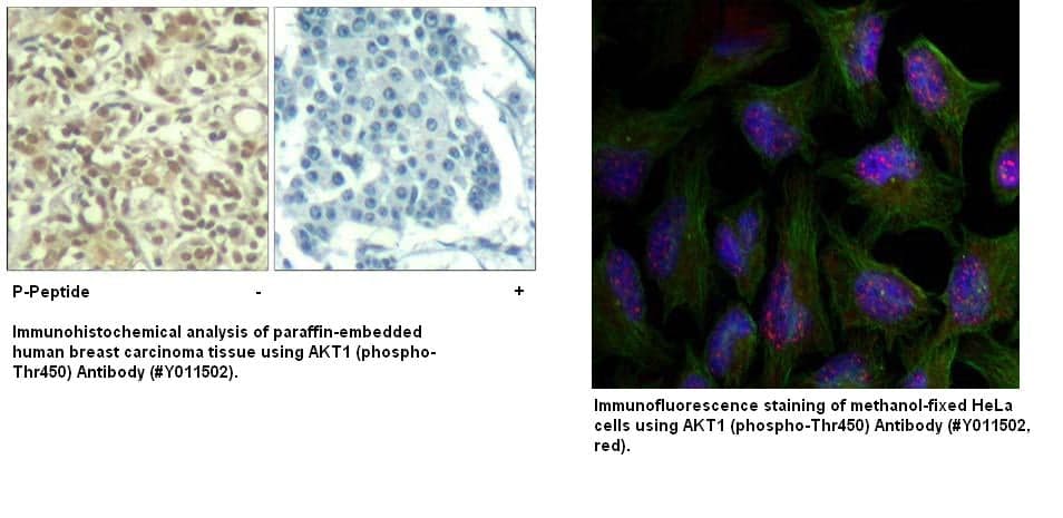 Anti-AKT1 (phospho-Thr450)