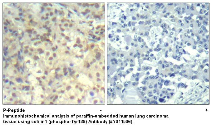 Anti-cofilin1 (phospho-Tyr139)