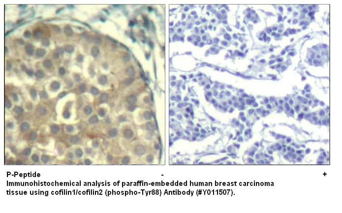 Anti-cofilin1/cofilin2 (phospho-Tyr88)