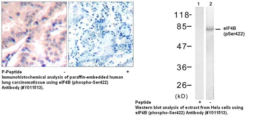 Anti-eIF4B (phospho-Ser422)