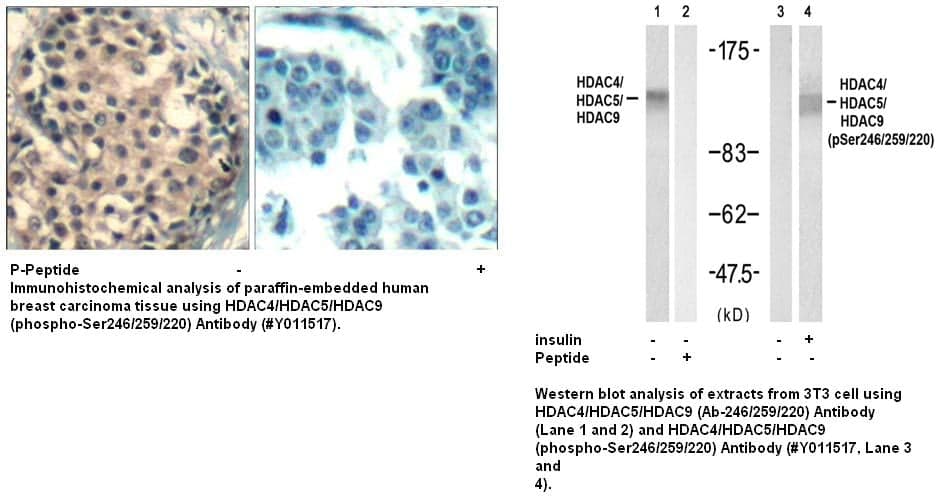 Anti-HDAC4/HDAC5/HDAC9 (phospho-Ser246/259/220)