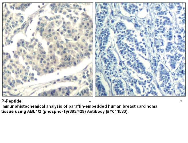 Anti-ABL1/2 (phospho-Tyr393/429)