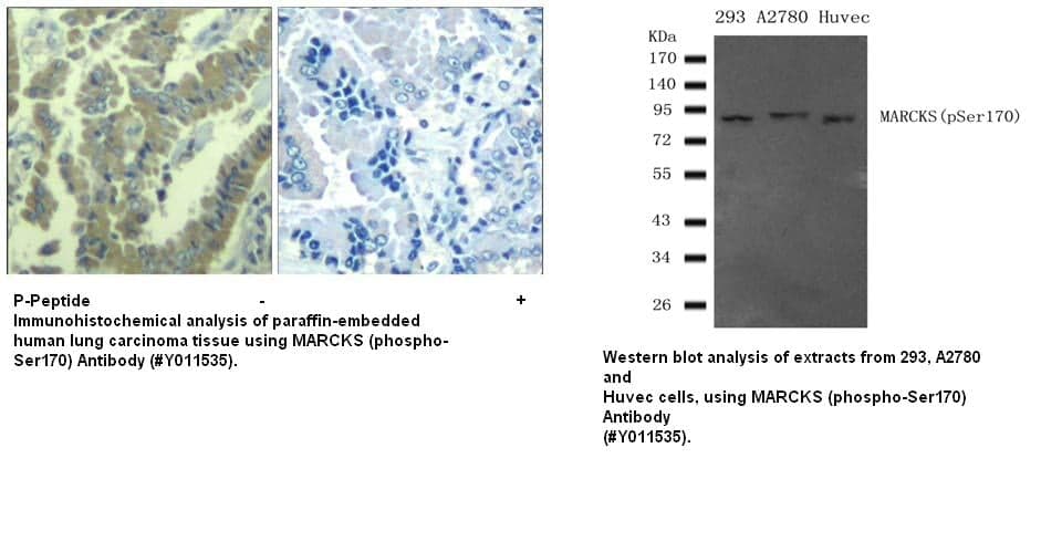 Anti-MARCKS (phospho-Ser170)