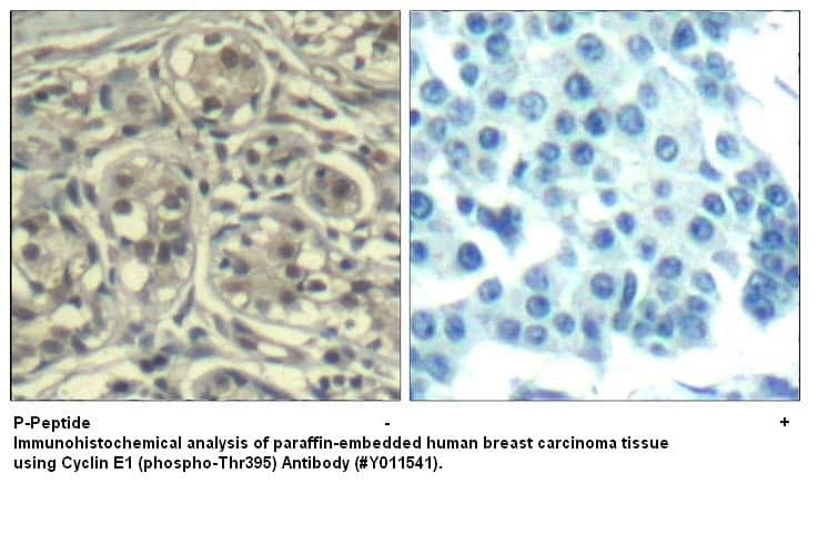 Anti-Cyclin E1 (phospho-Thr395)