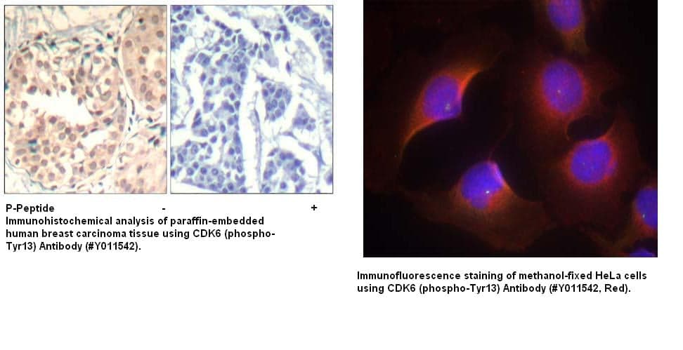 Anti-CDK6 (phospho-Tyr13)