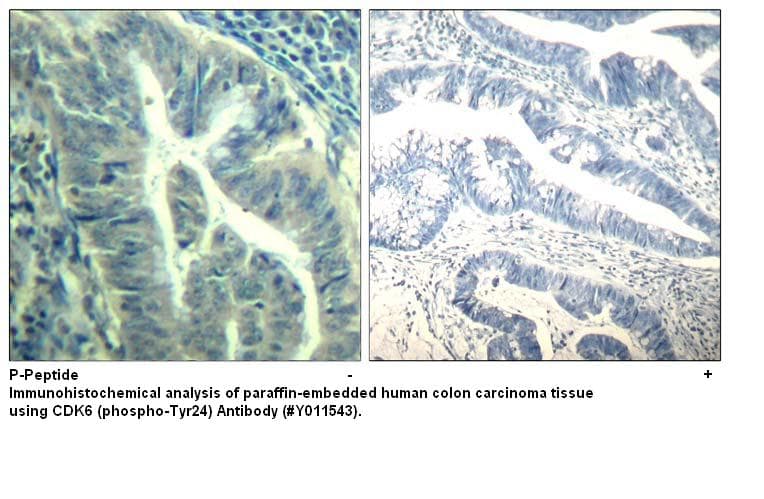 Anti-CDK6 (phospho-Tyr24)