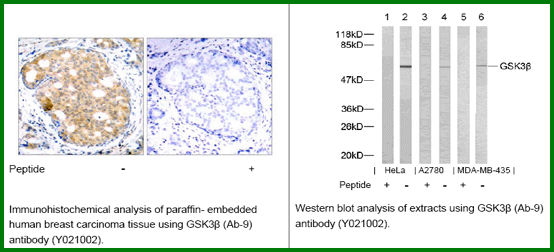 Anti-GSK3&beta; (Ab-9)