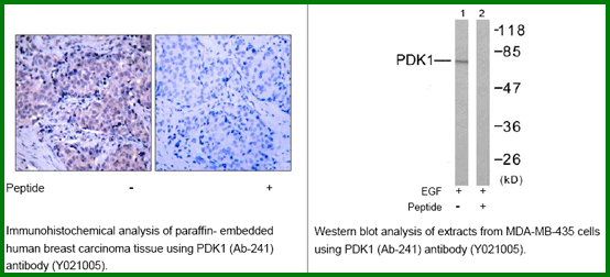 Anti-PDK1 (Ab-241)