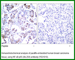Anti-NF-kB p65 (Ab-254)