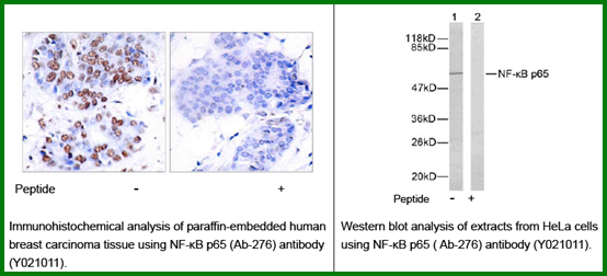 Anti-NF-kB p65 (Ab-276)