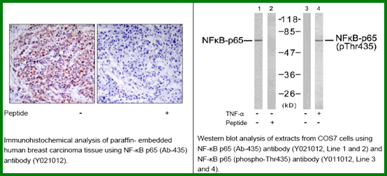 Anti-NF-kB p65 (Ab-435)