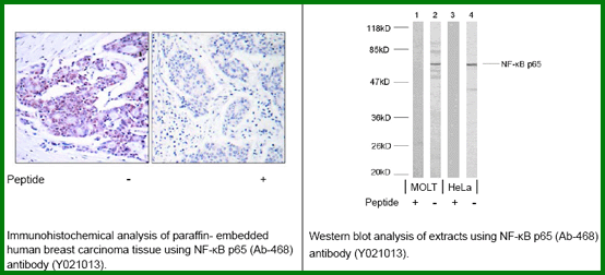 Anti-NF-kB p65 (Ab-468)