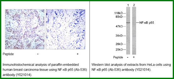 Anti-NF-kB p65 (Ab-536)