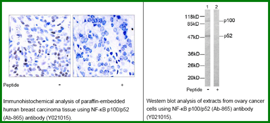 Anti-NF-kB p100/p52 (Ab-865)