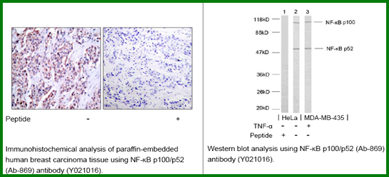 Anti-NF-kB p100/p52 (Ab-869)