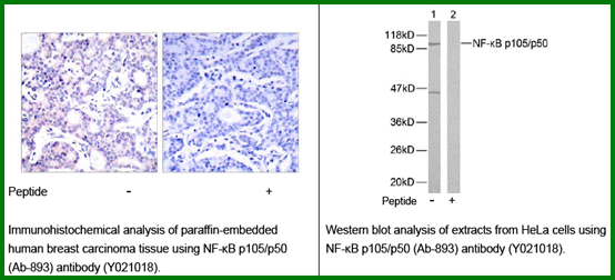 Anti-NF-kB p105/p50 (Ab-893)