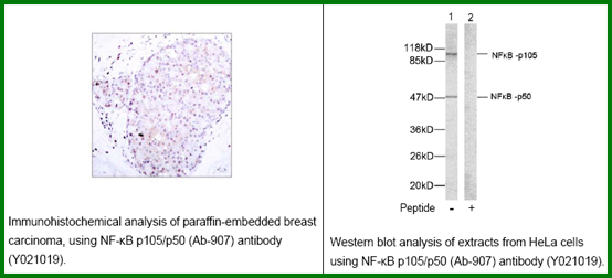 Anti-NF-kB p105/p50 (Ab-907)